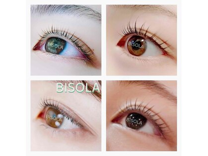 ビゾラ(BISOLA)の写真