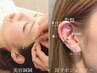 《美容鍼＋耳ツボジュエリー》セットクーポン◎通常¥19800→¥9900