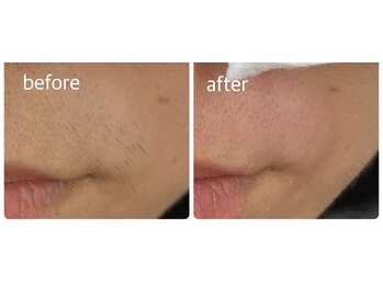 メイクマジック(Makemagic)/口周り1650円