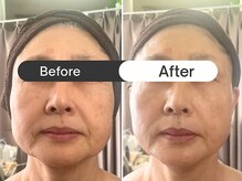 リラクゼーションサロン ラキ(laki)の雰囲気（何歳でも、圧倒的な水光肌で美人。たるみ/しみ/しわ/小顔まで◎）