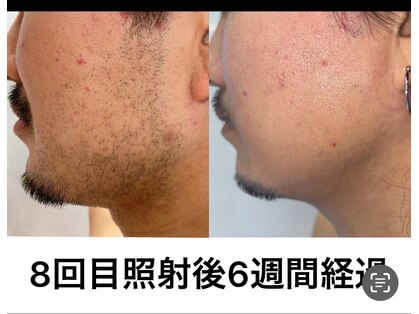 ルイース(LOUISE.)の写真