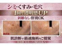 オンリーホープ(ONLY HOPE)