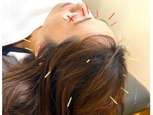 マーブル 熊本合志店