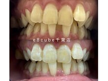 イイハキューブ(e8 cube)/before & after