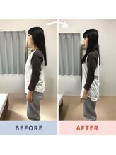 姿勢矯正院/美容面でも骨は大事！