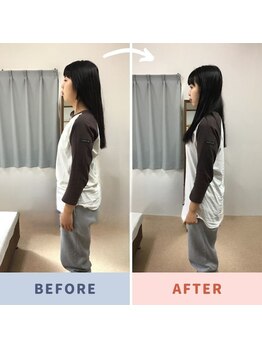 姿勢矯正院/美容面でも骨は大事!