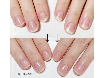 ホワイトネイル 武蔵小杉店(WHITE NAIL)の写真/自爪育成ハンドケアで丸爪、チビ爪、幅広い爪、剥離、改善◎誰もが羨む縦長の美爪へ★ネイルは4980円～♪