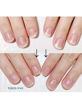 爪の悩みを解消できる（ケア含む）