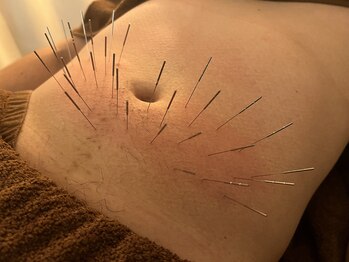 けんたろう鍼灸院/胃の不調