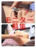 【10名/月　限定 ￥5,500】　 美容鍼（極 -Kiwami-）コース モニター募集！