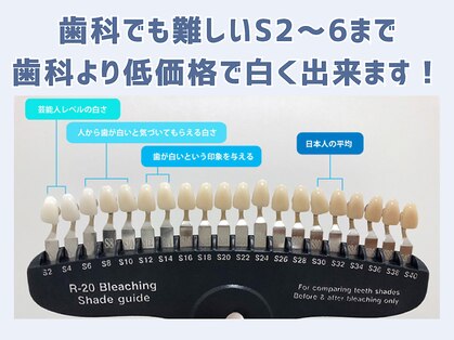 スマイルホワイト 練馬店の写真