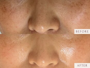 クラームビューティー(Clerm beauty)/【40代 女性】幹細胞プログラム