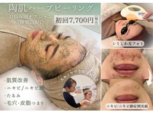 ニコリー(NICOLY)