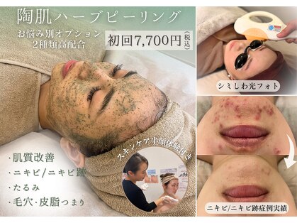 ニコリー(NICOLY)の写真