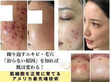 ルナティアラ(LUNAティアラ)