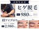 トレースの写真