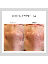 ポムハヌル(pom.haneul)/韓国肌管理室