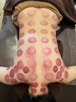 ベルダ(Beldad)/カッピング