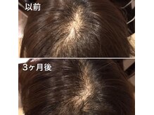 モユ(MOYU)の雰囲気（3か月後の効果です。）