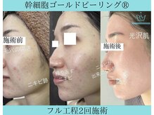 リメイククリニカルビューティー(Remake clinical beauty)/繰り返す