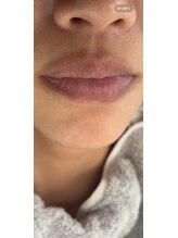 リ クリニカル ラボ(Re clinical Labo)/Roma &nbsp;Pink /before