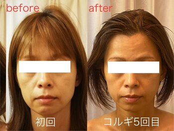 ビーキュート 神戸元町店(BE-CUTE)/コルギ5回目