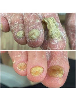 チェンジ(CHANGE)/爪カット