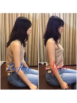 くまのみ整骨院 浦和コルソ院/猫背改善!