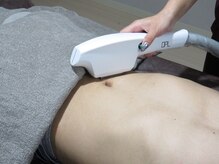 モアスリー(Moa3)/全身脱毛(顔 VIOなし)