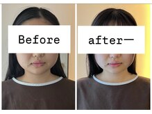 リモド(Rimodo509)/小顔矯正（ヘッドスパ