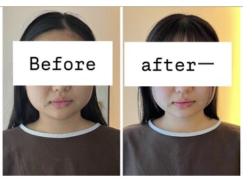 リモド(Rimodo509)/小顔矯正(ヘッドスパ