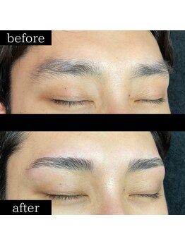 ユー 千葉駅前店(you)/症例写真