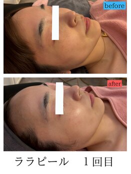 ユフラ(Juhla)/ララピール