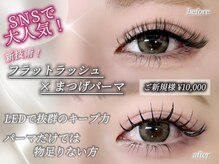 ティンクアイ(Tink eye)