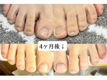 グラシナ 鳥丸店/フットも矯正できます