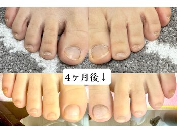 グラシナ 鳥丸店/フットも矯正できます