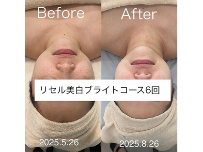 リージュ(Riju)の写真