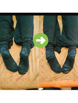 サプライズ整体院/30代ママさんの産後の骨盤初回