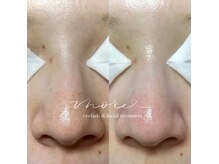 モア(MORE)の雰囲気（リピート率90%超え/毛穴改善エステ60分/10,000円 宇都宮・鶴田）