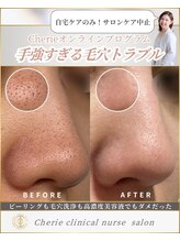 シェリー(Cherie)/施術なし！長年悩む毛穴ケア