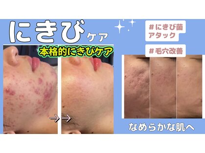 ミライ(Mirai)の写真