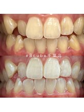 イイハキューブ(e8 cube)/before & after