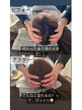 トトロ 明石大久保店(Totoro)/頭皮、浮腫んでいませんか？