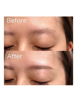 ビオラス(Biolus)/圧倒的!人気No.1メニュー!!