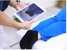 施術前の歪みの状態を画像でご本人に確認していただきます