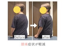 整体あゆむ 立川店/before after6
