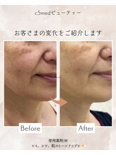 シーファイブメットビューティ 西11丁目店(C5medビューティ)/ビフォーアフター