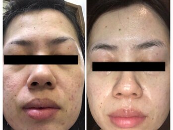 ビューティーサロンリノ 三宮店(Lino)/