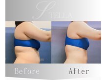 ステラ(STELLA)/上半身プレミアムの効果