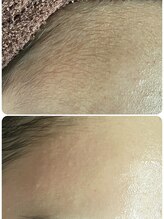 スティーン(Styin)/顔ワックス脱毛【京丹後】